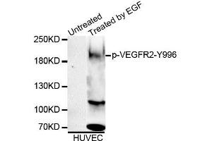 Western blot analysis of extracts of HUVEC cell line, using Phospho-VEGFR2-Y996 antibody (ABIN5995624). (VEGFR2/CD309 antibody  (pTyr996))