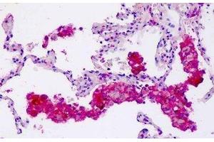 Human Lung, Macrophages: Formalin-Fixed, Paraffin-Embedded (FFPE) (Coronin 6 antibody  (AA 337-365))