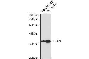 Western blot analysis of extracts of various cell lines, using DAZL antibody (ABIN6130243, ABIN6139416, ABIN6139417 and ABIN6218163) at 1:1000 dilution. (DAZL antibody  (AA 186-295))