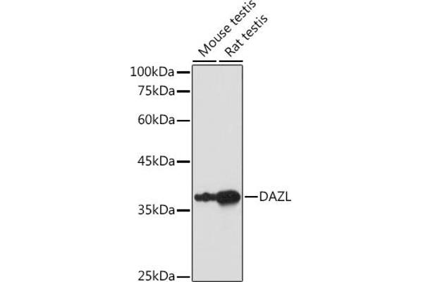 DAZL antibody  (AA 186-295)