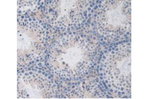 IHC-P analysis of Mouse Testis Tissue, with DAB staining. (LSR antibody  (AA 35-205))
