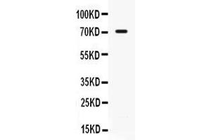 Western blot analysis of IL7R alpha expression in 22RV1 whole cell lysates ( Lane 1).