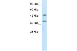 Human Jurkat; WB Suggested Anti-PNMA1 Antibody Titration: 0. (PNMA1 antibody  (Middle Region))
