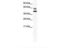Image no. 1 for anti-Zinc Finger and BTB Domain Containing 7A (ZBTB7A) (AA 114-163) antibody (ABIN202736) (ZBTB7A antibody  (AA 114-163))
