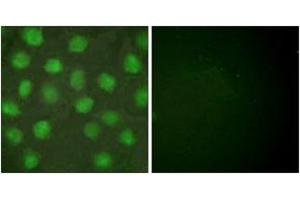 Immunofluorescence analysis of HuvEc cells, using Retinoid X Receptor gamma Antibody. (Retinoid X Receptor gamma antibody  (AA 171-220))