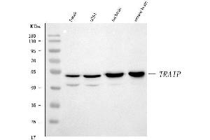 Western blot analysis of TRIP/TRAIP using anti-TRIP/TRAIP antibody (ABIN7599419). (TRAIP antibody  (AA 1-469))