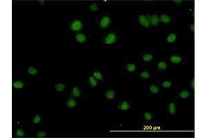 Immunofluorescence of monoclonal antibody to TOPORS on HeLa cell. (TOPORS antibody  (AA 98-205))