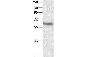 Western Blot analysis of Huamn fetal brain tissue using CRMP3 Polyclonal Antibody at dilution of 1:500 (DPYSL4 antibody)