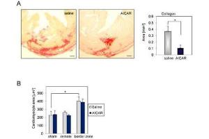 Immunohistochemistry (IHC) image for anti-Collagen, Type I (COL1) antibody (ABIN5596819)