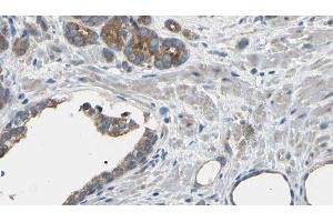Immunohistochemistry (IHC) image for anti-Eukaryotic Translation Initiation Factor 3, Subunit D (EIF3D) (Internal Region) antibody (ABIN6258372)