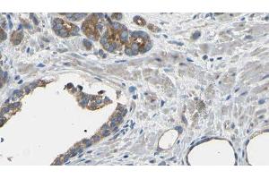 ABIN6275122 at 1/100 staining Human prostate tissue by IHC-P. (EIF3D antibody  (Internal Region))