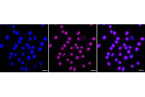Immunocytochemical staining of HepG2 cells with LYN antibody (ABIN7800949), 1:1,000). (Recombinant LYN Proto-Oncogene antibody)