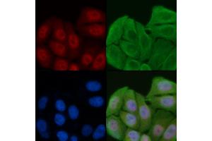 ABIN6261305 and ABIN6276929 staining Hela cells by IF/ICC. (DKC1 antibody  (Internal Region))