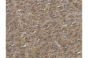 IHC analysis of ALDH1L1 using anti-ALDH1L1 antibody (ABIN7601093). (ALDH1L1 antibody  (AA 282-424))