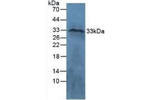 Detection of CTGF in Ovine Brain Tissue using Polyclonal Antibody to Connective Tissue Growth Factor (CTGF) (CTGF antibody  (AA 101-330))