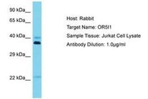 Image no. 1 for anti-Olfactory Receptor, Family 5, Subfamily I, Member 1 (OR5I1) (C-Term) antibody (ABIN6750583) (OR5I1 antibody  (C-Term))