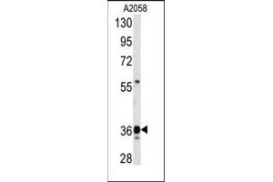 Image no. 1 for anti-Glyceraldehyde-3-Phosphate Dehydrogenase (GAPDH) (C-Term) antibody (ABIN360237) (GAPDH antibody  (C-Term))
