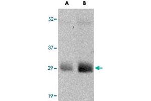 Western blot analysis of GBAS in human skeletal muscle tissue lysate with GBAS polyclonal antibody  at (A) 0. (GBAS antibody  (N-Term))