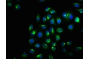 Immunofluorescence staining of Hela cells with ABIN7127692 at 1:100, counter-stained with DAPI. (Recombinant ERN1 antibody  (pSer724))