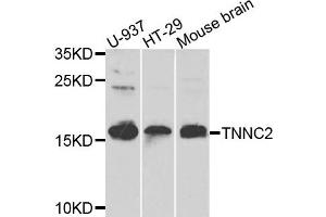 Western blot analysis of extracts of various cells, using TNNC2 antibody.