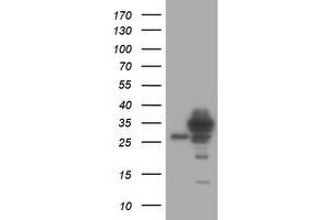 Image no. 1 for anti-Signal Recognition Particle Receptor, B Subunit (SRPRB) antibody (ABIN1501129) (SRPRB antibody)
