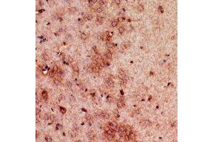 Immunohistochemical analysis of GDI2 staining in mouse brain formalin fixed paraffin embedded tissue section. (GDI2 antibody  (C-Term))