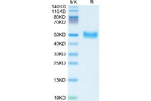 PEDF Protein (AA 20-417) (His tag)