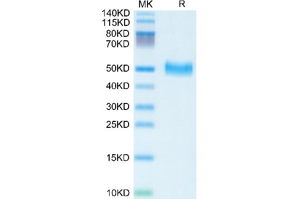 PEDF Protein (AA 20-417) (His tag)