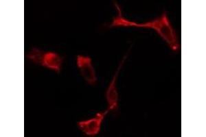 ABIN6275092 staining  Hela cells by IF/ICC. (RFWD2 antibody  (Internal Region))