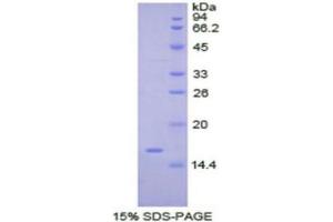SDS-PAGE (SDS) image for Tryptase alpha/beta 1 (TPSAB1) (AA 29-148) protein (His tag) (ABIN1879980)