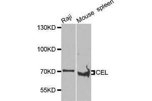 Western blot analysis of extracts of Raji and mouse spleen cells, using CEL antibody. (Cholesterol Esterase antibody)