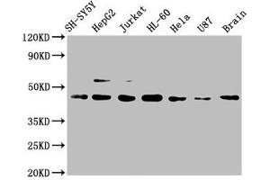 Western Blot Positive WB detected in: SH-SY5Y whole cell lysate, HepG2 whole cell lysate, Jurkat whole cell lysate, HL-60 whole cell lysate, Hela whole cell lysate, U87 whole cell lysate, Mouse brain tissue All lanes: CCR9 antibody at 1 μg/mL Secondary Goat polyclonal to rabbit IgG at 1/50000 dilution Predicted band size: 43, 41 KDa Observed band size: 43 KDa (Recombinant CCR9 antibody)