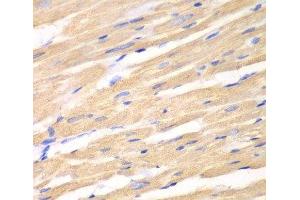 Immunohistochemistry of paraffin-embedded Rat heart using DKK3 Polyclonal Antibody at dilution of 1:100 (40x lens).