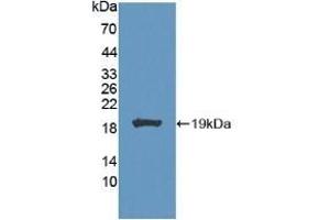Detection of Recombinant CA7, Mouse using Polyclonal Antibody to Carbonic Anhydrase VII (CA7) (CA7 antibody  (AA 58-217))
