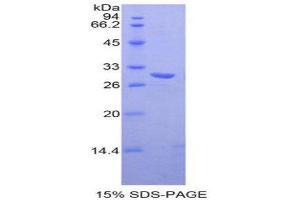 SDS-PAGE (SDS) image for TXK tyrosine Kinase (TXK) (AA 286-509) protein (His tag) (ABIN2127150) (TXK Protein (AA 286-509) (His tag))