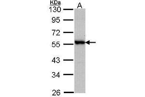 WB Image Sample (30 ug of whole cell lysate) A: A431 , 10% SDS PAGE antibody diluted at 1:1000 (DOK3 antibody  (C-Term))