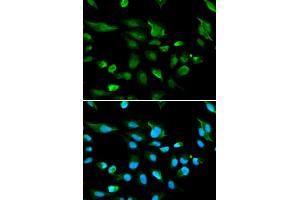 Immunofluorescence analysis of A549 cells using AIRE antibody (ABIN5970888). (AIRE antibody)