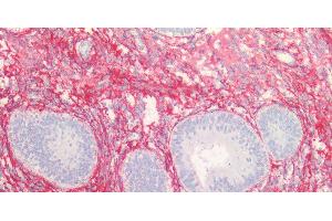Immunohistochemistry of paraffin-embedded Human endometrium and prostate using COL3A1 Polyclonal Antibody at dilution of 1:100. (COL3A1 antibody)