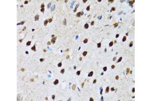 Immunohistochemistry of paraffin-embedded Rat brain using CCAR2 Polyclonal Antibody at dilution of 1:100 (40x lens). (CCAR2 antibody)