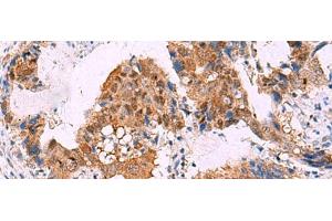 Immunohistochemistry (Paraffin-embedded Sections) (IHC (p)) image for anti-FK506 Binding Protein 4, 59kDa (FKBP4) antibody (ABIN7247213)