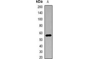 Western blot analysis of Nyctalopin expression in HEK293T (A) whole cell lysates. (Nyctalopin antibody)