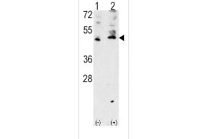 Western blot analysis of VEGF3 Antibody polyclonal antibody using 293 cell lysates (2 ug/lane) either nontransfected (Lane 1) or transiently transfected with the VEGF3 gene (Lane 2).
