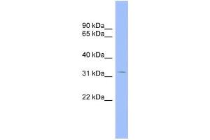 WB Suggested Anti-CNOT7 Antibody Titration:  0. (CNOT7 antibody  (Middle Region))