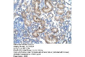 Human kidney (AADAT antibody  (N-Term))