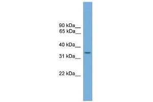 WB Suggested Anti-SLC35A4 Antibody Titration:  0. (SLC35A4 antibody  (Middle Region))