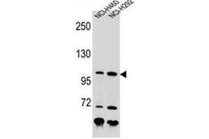 Western blot analysis of Nibrin Antibody (C-term) in NCI-H460, NCI-H292 cell line lysates (35ug/lane). (Nibrin antibody  (C-Term))