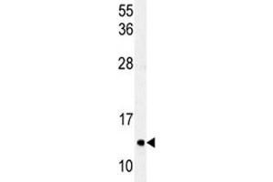 Western blot analysis of LC3C antibody and HeLa lysate (LC3C antibody  (AA 27-57))