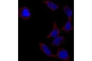 Image no. 2 for anti-POU Class 5 Homeobox 1 (POU5F1) antibody (ABIN357429) (OCT4 antibody)