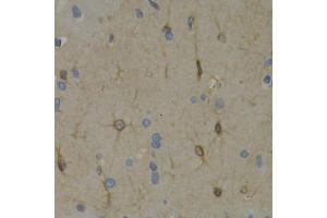 Immunohistochemistry of paraffin-embedded rat brain using WNT3A antibody (ABIN6292349) at dilution of 1:200 (40x lens). (WNT3A antibody)