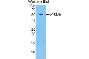 Detection of Recombinant CPT1A, Mouse using Polyclonal Antibody to Carnitine Palmitoyltransferase 1A, Liver (CPT1A) (CPT1A antibody  (AA 568-773))